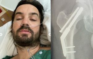 Kevin Parker, de Tame Impala, fue operado de urgencia tras sufrir una fractura en la cadera.