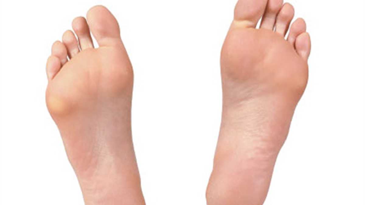 Sobre los dedos, aunque también en las puntas de éstos o en la planta del pie. 

