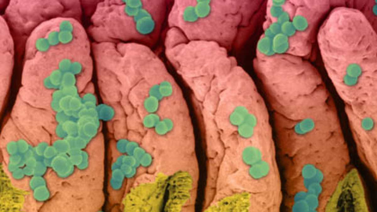 En esta imagen los estafilococos dorados están pegados a la piel del intestino. Crecen como racimos de uvas