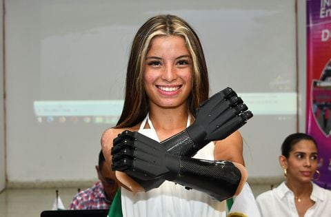 Karol Michelle Bastidas deportista que recibió dos prótesis inteligentes. Karol perdió sus brazos por una descarga eléctrica.
