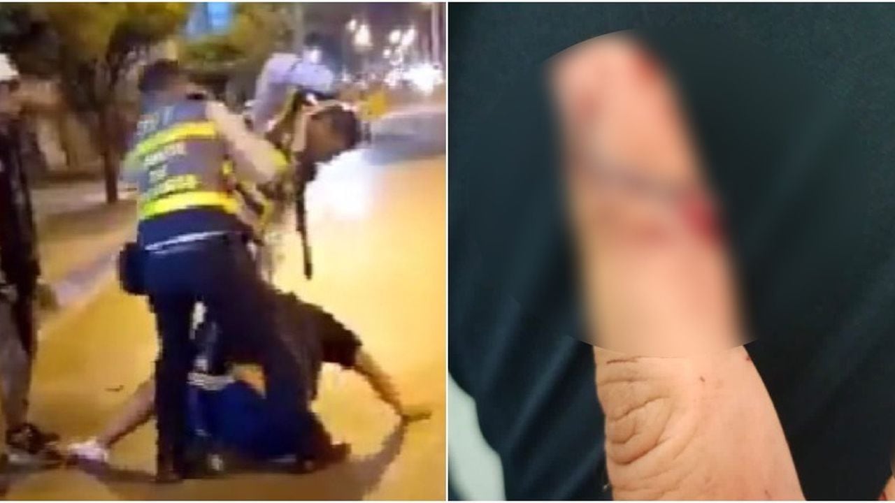 Uno de los agentes de tránsito dijo que el ciudadano le mordió un dedo.