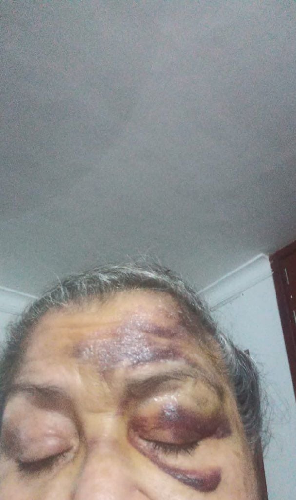 Adulta mayor brutalmente golpeada en Santa Marta | Foto: Twitter @everstrongever