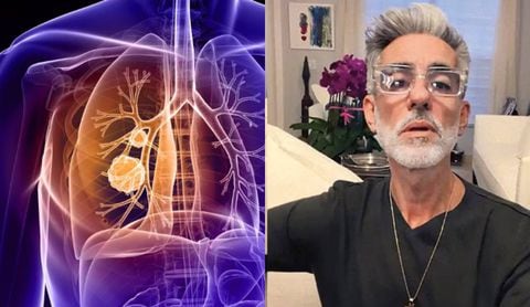 El actor habló de su salud y envió mensaje relacionado con el cáncer de pulmón.
