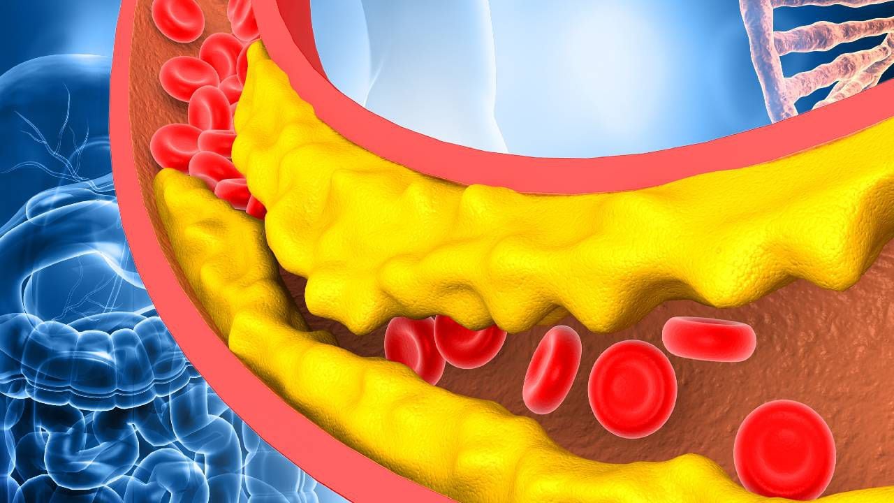 Los niveles de colesterol se puede regular con una dieta saludable y practicar deporte regularmente. Foto: Getty images.