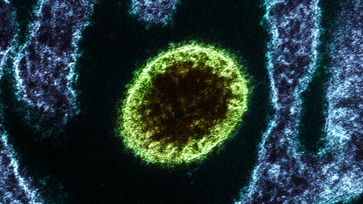 El Nipah: ¿Causará este virus la próxima pandemia?