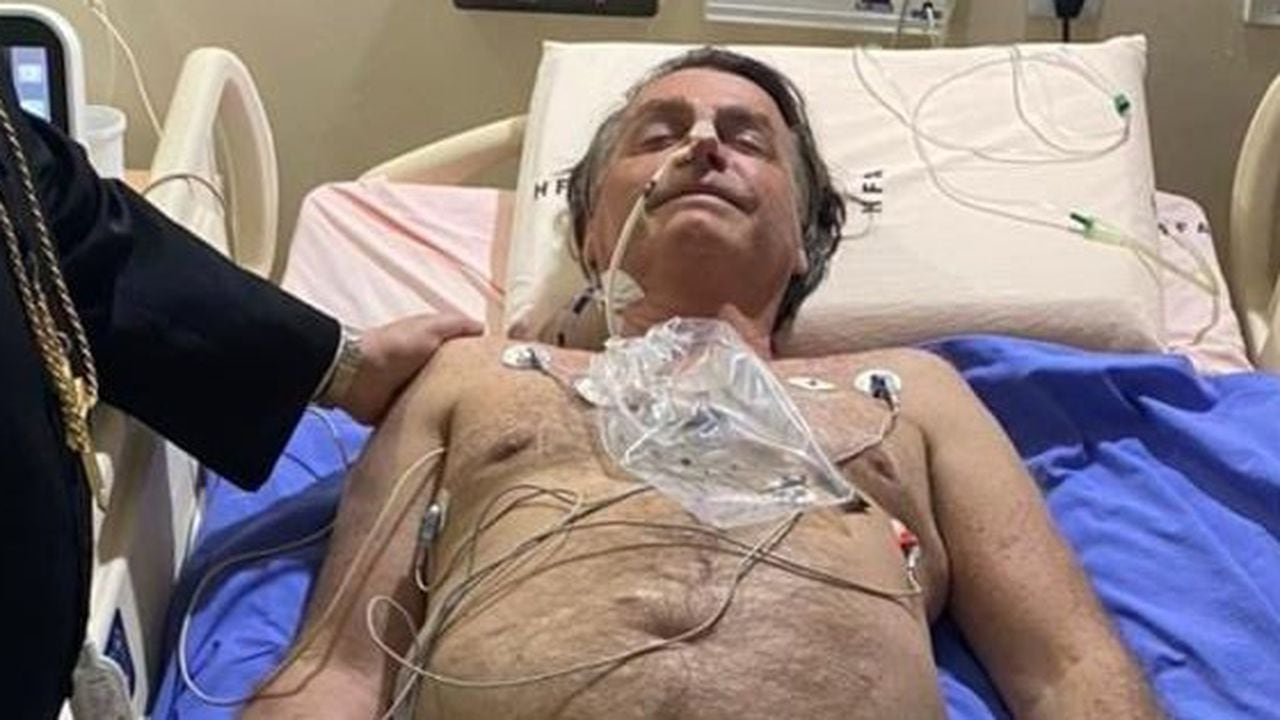 Jair Boslonaro está hospitalizado por un hipo persistente causado por una obstrucción intestinal