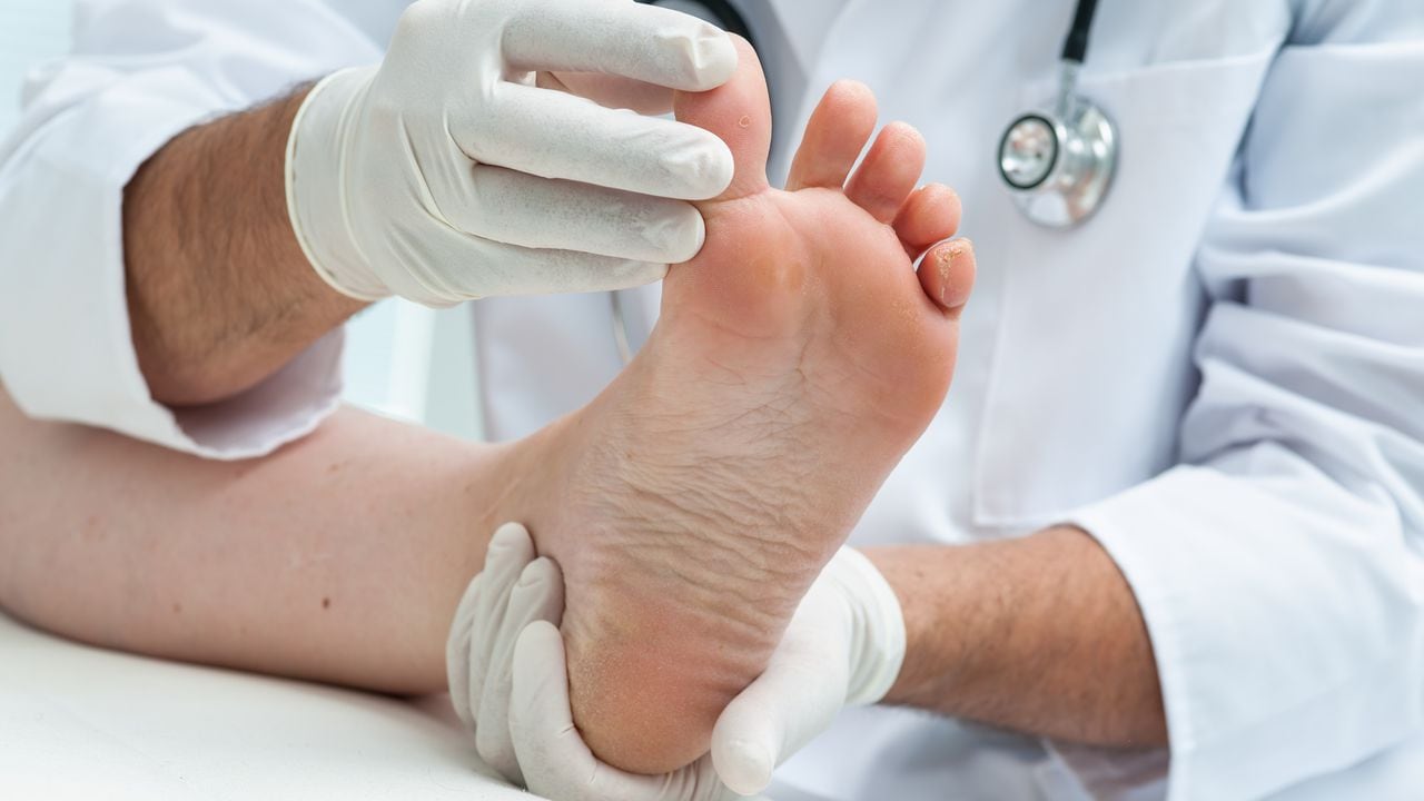 Doctor dermatologist examines the foot on the presence of athlete's foot