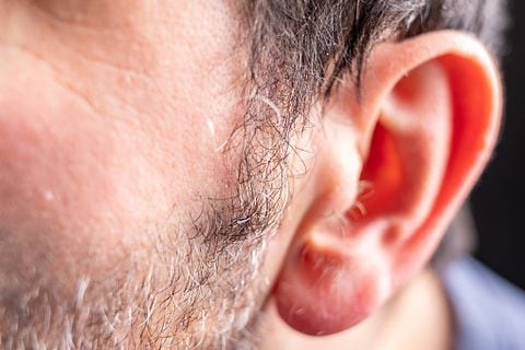 Es importante tener cuidado de no cortar las orejas al realizar estos métodos.