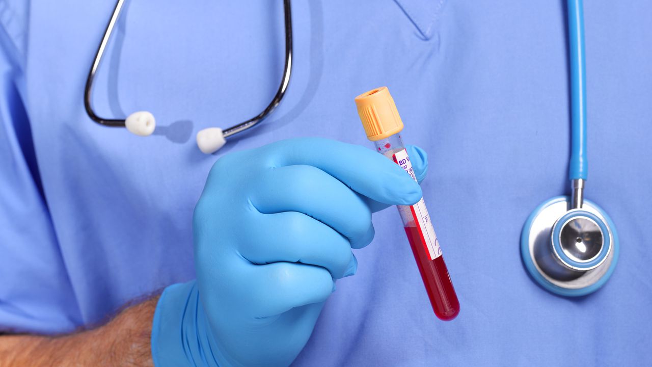 Un doctor haciendo exámenes de sangre- Imagen de referencia