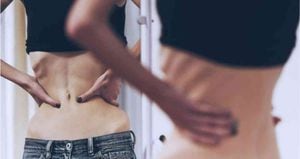 La anorexia es un desorden alimenticio que lleva a la gente a perder el mayor peso posible comiendo muy poco y, algunas veces, haciendo ejercicio en exceso. Foto: BBC