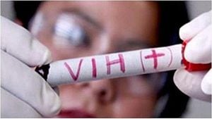 El virus de inmunodeficiencia humana (VIH) es causante del sida. (AFP)