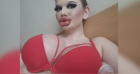 Andrea Ivanova quiere ser reconocida como la mujer con los labios más grandes del mundo.