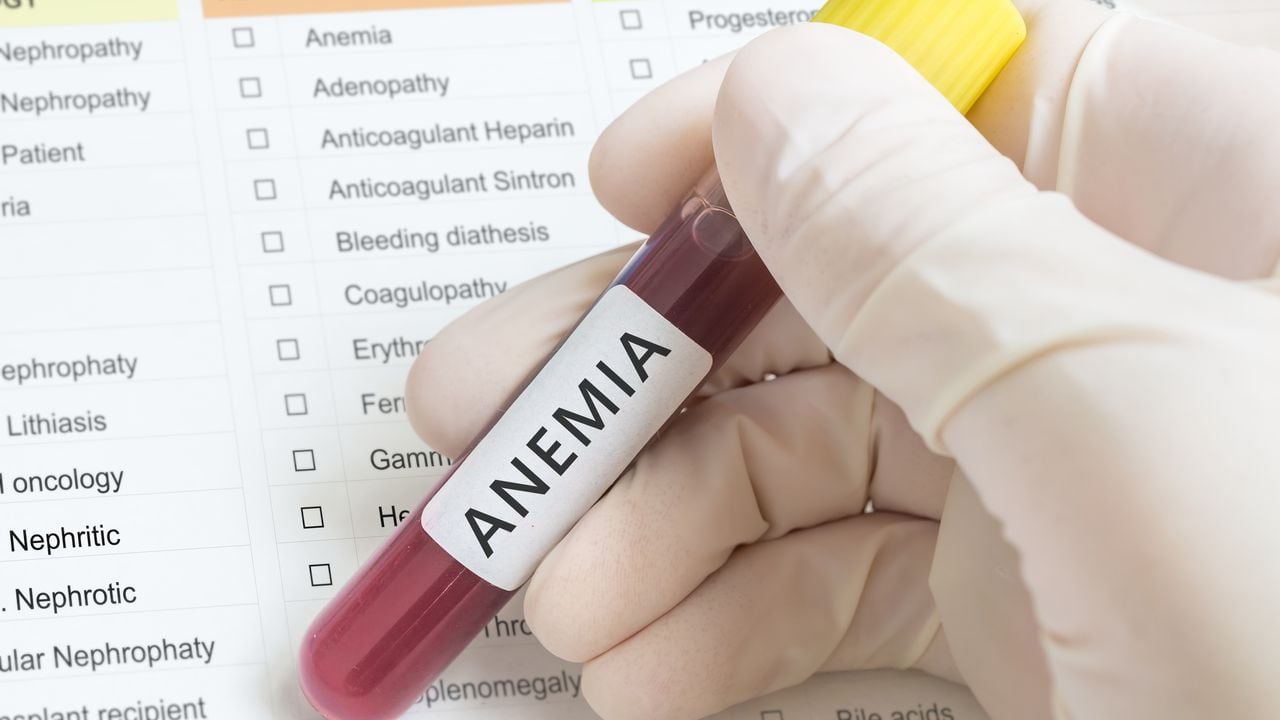 La anemia es una afección relacionada con la sangre.