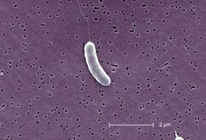 Esta micrografía electrónica de barrido Sem representa una bacteria Vibrio Vulnificus flagelada; revista 13184X. Vibrio Vulnificus es una bacteria de la misma familia que las que causan el cólera. Normalmente vive en agua de mar tibia y es parte de un grupo de vibriones que se llaman "halofílicos" porque requieren sal.