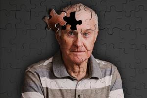 alzheimer's, memory loss and senile dementure