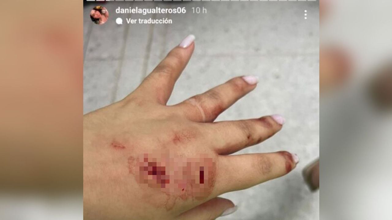 Al parecer Ana Camila Blanco habría apuñalado a Daniela Gualteros.
