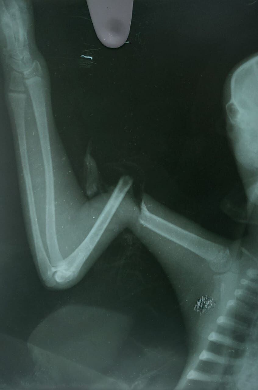 Radiografía de la fractura de oso perezoso que fue atacado en Santander.