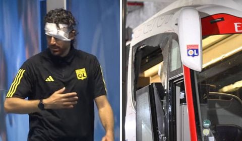 Fabio Grosso sufrió afectaciones en su rostro tras el ataque del bus al Lyon