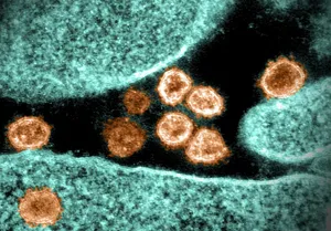 Variante iota, advierten cómo esta nueva cepa del coronavirus se expande con mayor rapidez