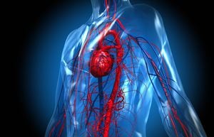Si una arteria resulta obstruida, esto puede llevar a que se presente un ataque cardíaco o un accidente cerebrovascular.