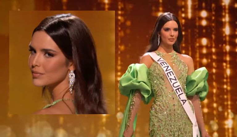 Miss Venezuela contó un detalle de su rostro que fue atendido por un especialista, tiempo antes de ir a Miss Universo.