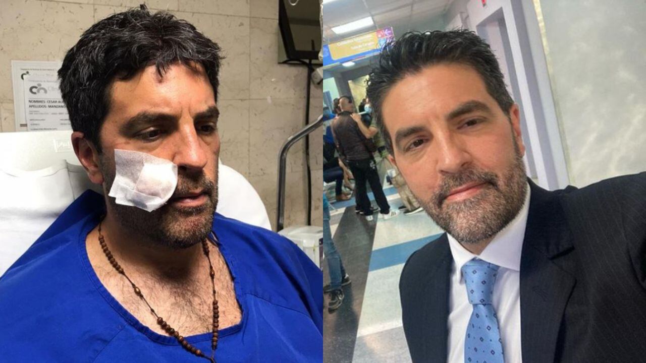 Video: Actor César Manzano recibió un disparo en su rostro en medio de un atraco en el norte de Bogotá