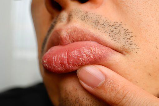 Tus labios se resecan mucho con el frío? 🥶 ¡No te preocupes porque h