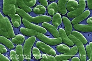 Agrupación de la bacteria Vibrio vulnificus revelada en la imagen microscópica electrónica de barrido (SEM) ampliada 13184x, 2005. Imagen cortesía de los Centros para el Control de Enfermedades