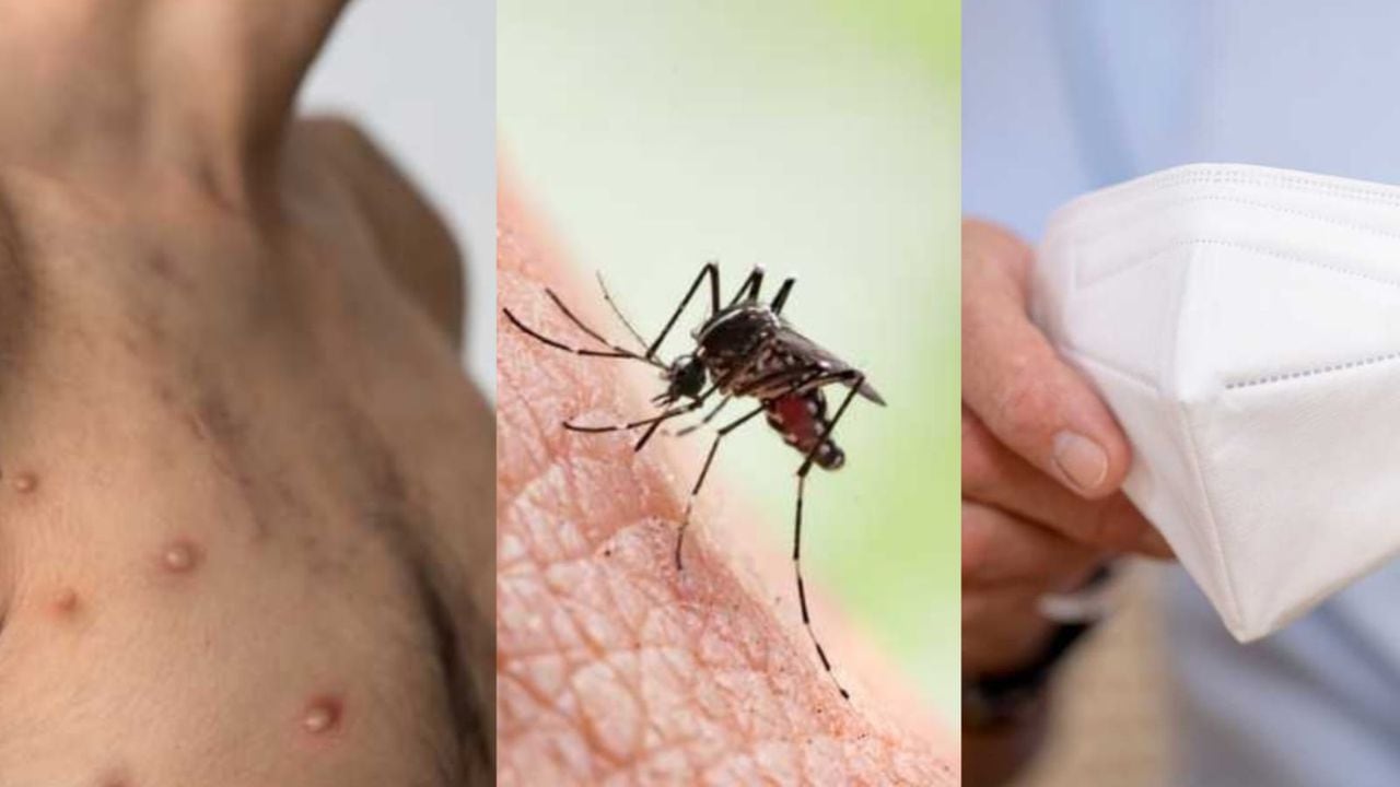 Viruela de mono, dengue y covid
