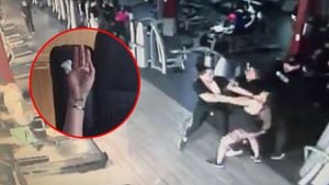 Escalofriantes imágenes: así le quedó el dedo a la mujer a la que se lo arrancaron durante pelea por una máquina en el gimnasio