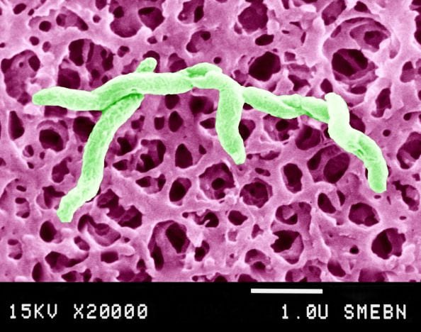 Campylobacter es una familia de bacterias Gram negativas curvas. Se han identificado varias especies. Campylobacter Pylori El agente causal de gastritis, úlceras. . . , Campylobacter Fetus y Campylobacter Jejuni. Microscopía electrónica de barrido de Campylobacter Jejuni. Semi 20000X. (Foto de BSIP/UIG a través de Getty Images)