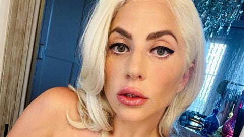 Lady Gaga publica video al natural donde deja ver sus manchas y acné