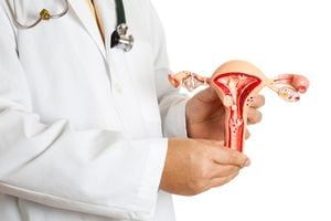 Doctor sosteniendo un modelo de útero y ovarios con algunas patologías más comunes, endometriosis, adherencias, fibromas, salpingitis, quistes, tumores de fibromas pedunculados, pólipos y varios carcinoma.