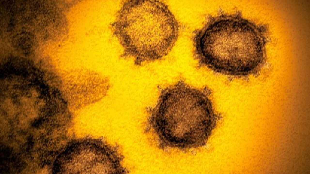 El nuevo coronavirus hace que algunas personas presenten síntomas graves mientras que otras no presenten ninguno.