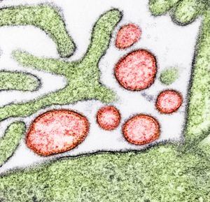 Micrografía electrónica de transmisión coloreada de partículas extracelulares maduras del virus Nipah (rojo) cerca de la periferia de una célula VERO infectada (verde).