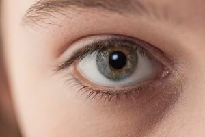 Las úlceras oculares son "irreversibles".