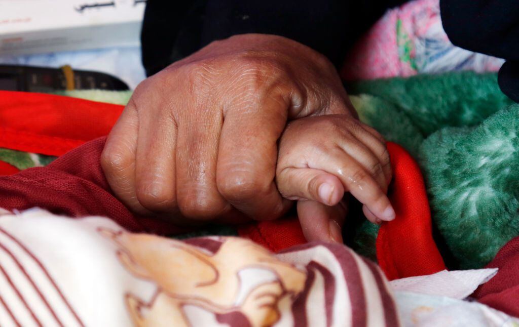 Una madre yemení toma la mano de su hijo mientras éste sufre desnutrición aguda y recibe tratamiento en un centro médico el 28 de febrero de 2023 en Sana'a, Yemen (Foto de Mohammed Hamoud/Getty Images)
