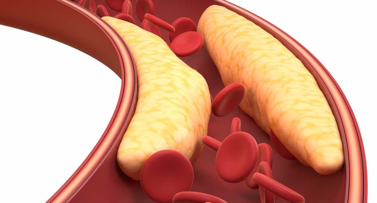 Trigliceridos alimentos