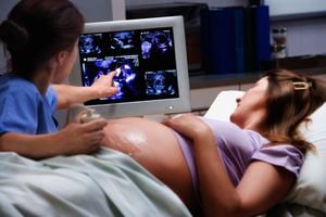 ¿Cuáles son los síntomas del embarazo?