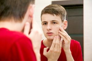 Cerca de un joven atractivo con piel problemática y cicatrices de acné se ve en el espejo del baño