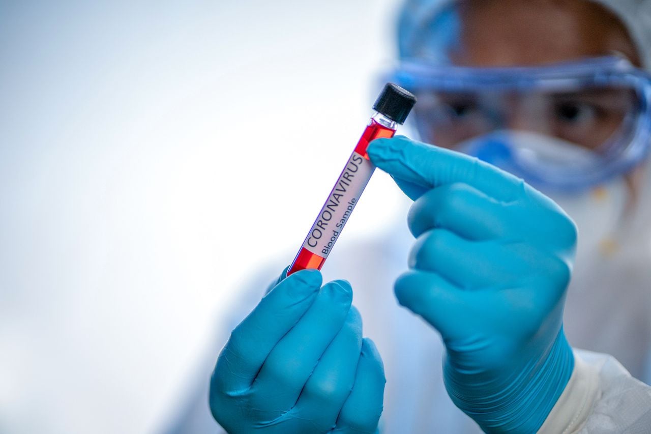 Científico con traje protector y máscara sostiene un tubo de ensayo con muestra biológica, sangre del paciente contaminada. SARS-CoV-2