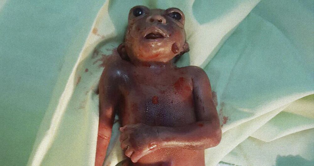   Una de las imágenes más impactantes es la de este bebé nacido muerto en la vereda Patio Bonito.