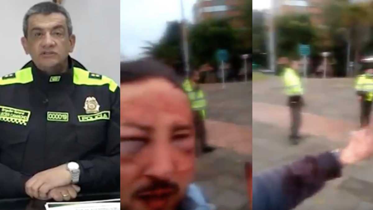 Hombre herido en Bogotá