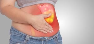 La úlcera estomacal es muy común, pero se debe tratar lo más rápido posible y en su periodo de recuperación cambiar uno que otro hábito. Foto: Getty Images