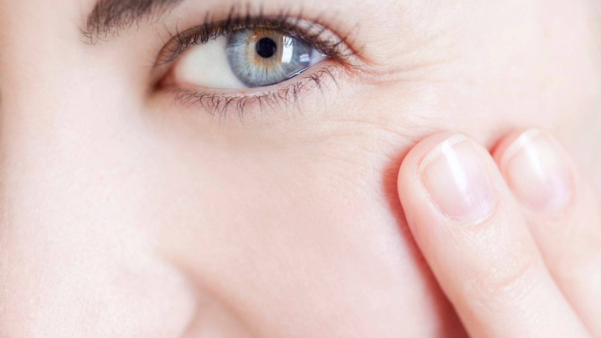 autómata deficiencia Minero Arrugas en la cara: cinco remedios naturales para reducirlas