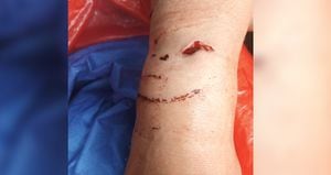   Una mujer indígena resultó herida en su brazo derecho con un arma cortopunzante luego de que en el interior de La Rioja se presentara una riña por consumo de licor y sustancias psicoactivas. 