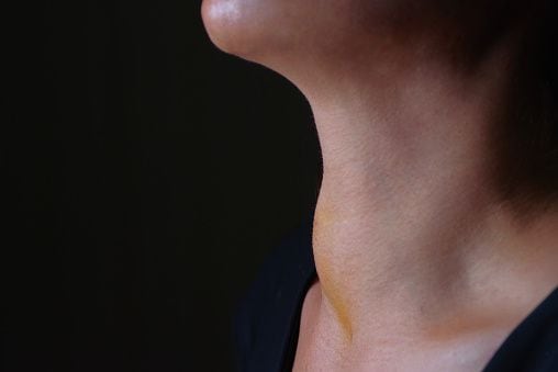 Frente al hipotiroidismo (cuando no produce suficiente hormona tiroidea), los síntomas se relacionan con una disminución en la actividad funcional de todos los sistemas del organismo.