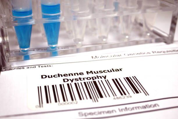 La Distrofia Muscular de Duchenne es un trastorno genético que afecta progresivamente los músculos.
