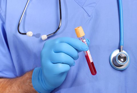 Un doctor haciendo exámenes de sangre- Imagen de referencia