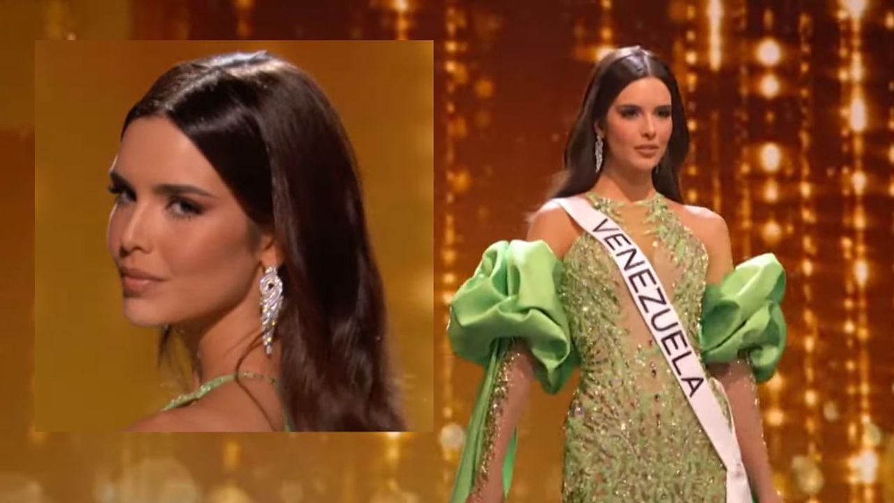 Miss Venezuela contó un detalle de su rostro que fue atendido por un especialista, tiempo antes de ir a Miss Universo.